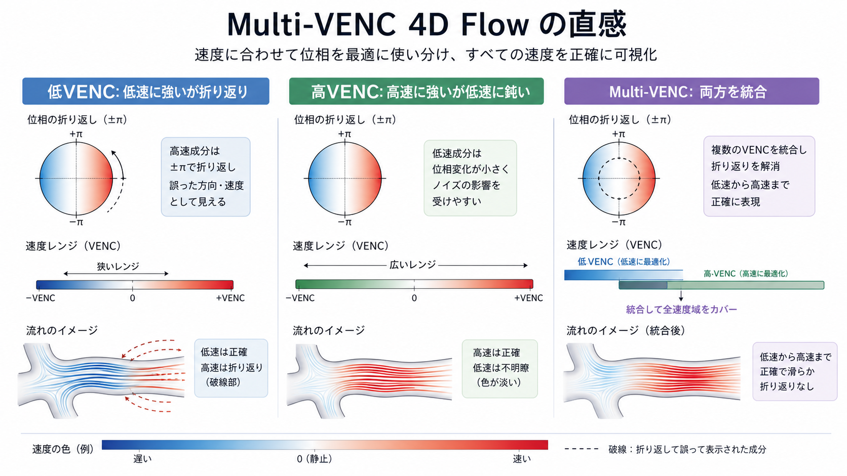 Multi-VENC 4D Flowの直感図