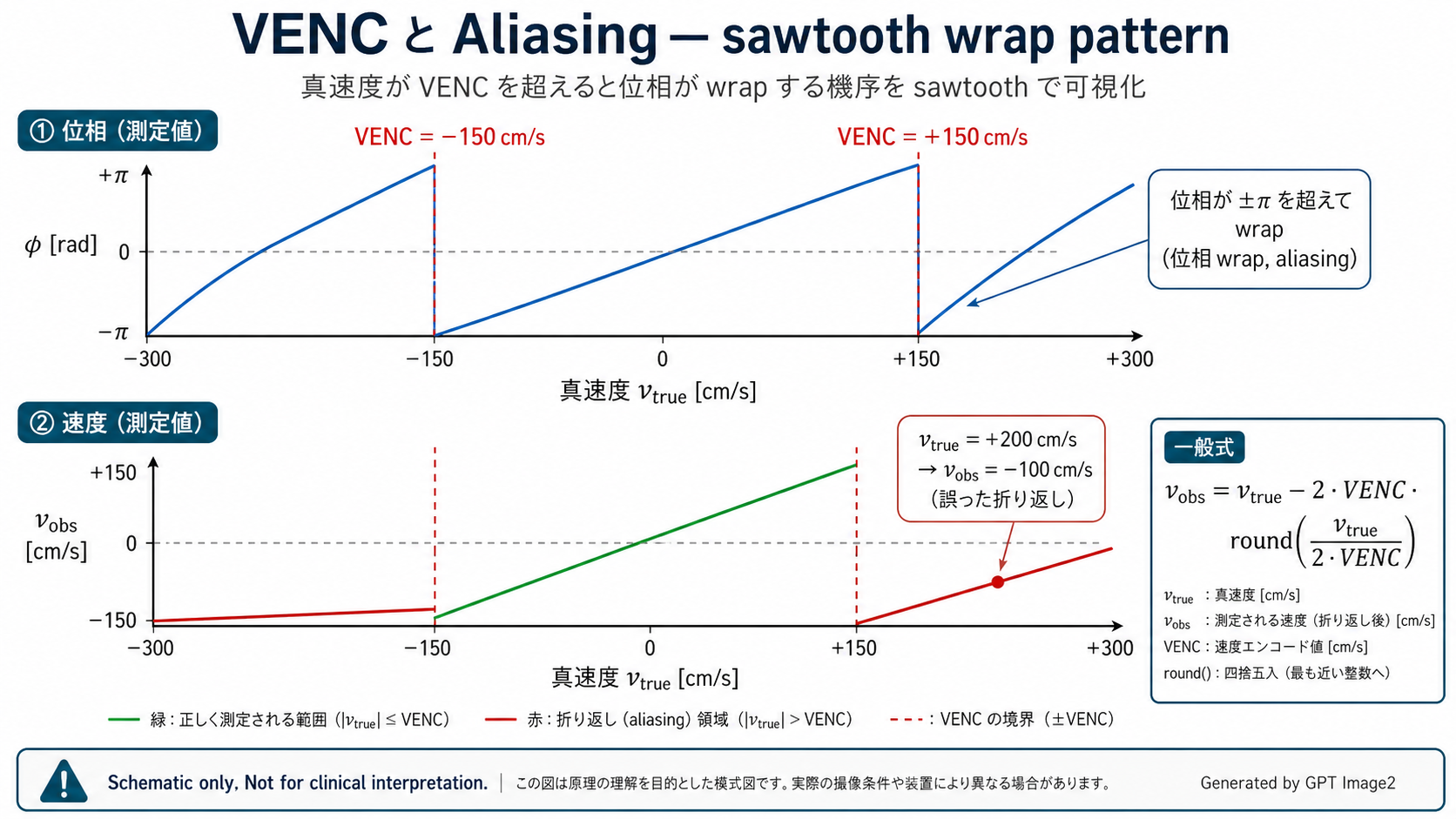 VENC と aliasing の関係: sawtooth wrap pattern