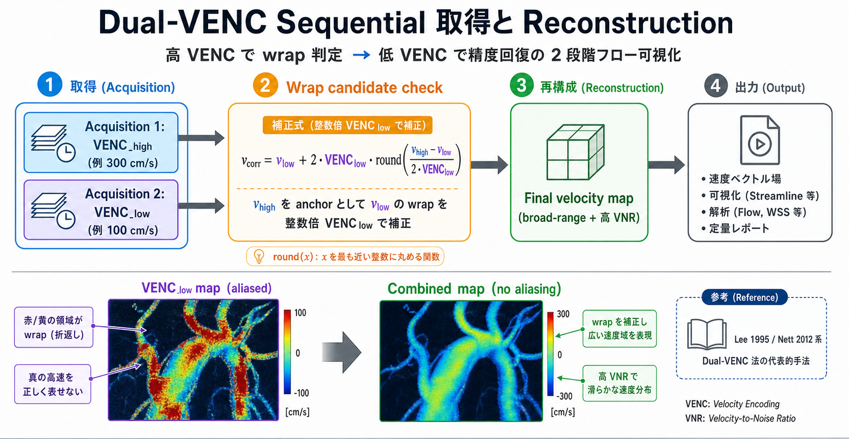 Dual-VENC sequential acquisition と reconstruction の 2 段階フロー