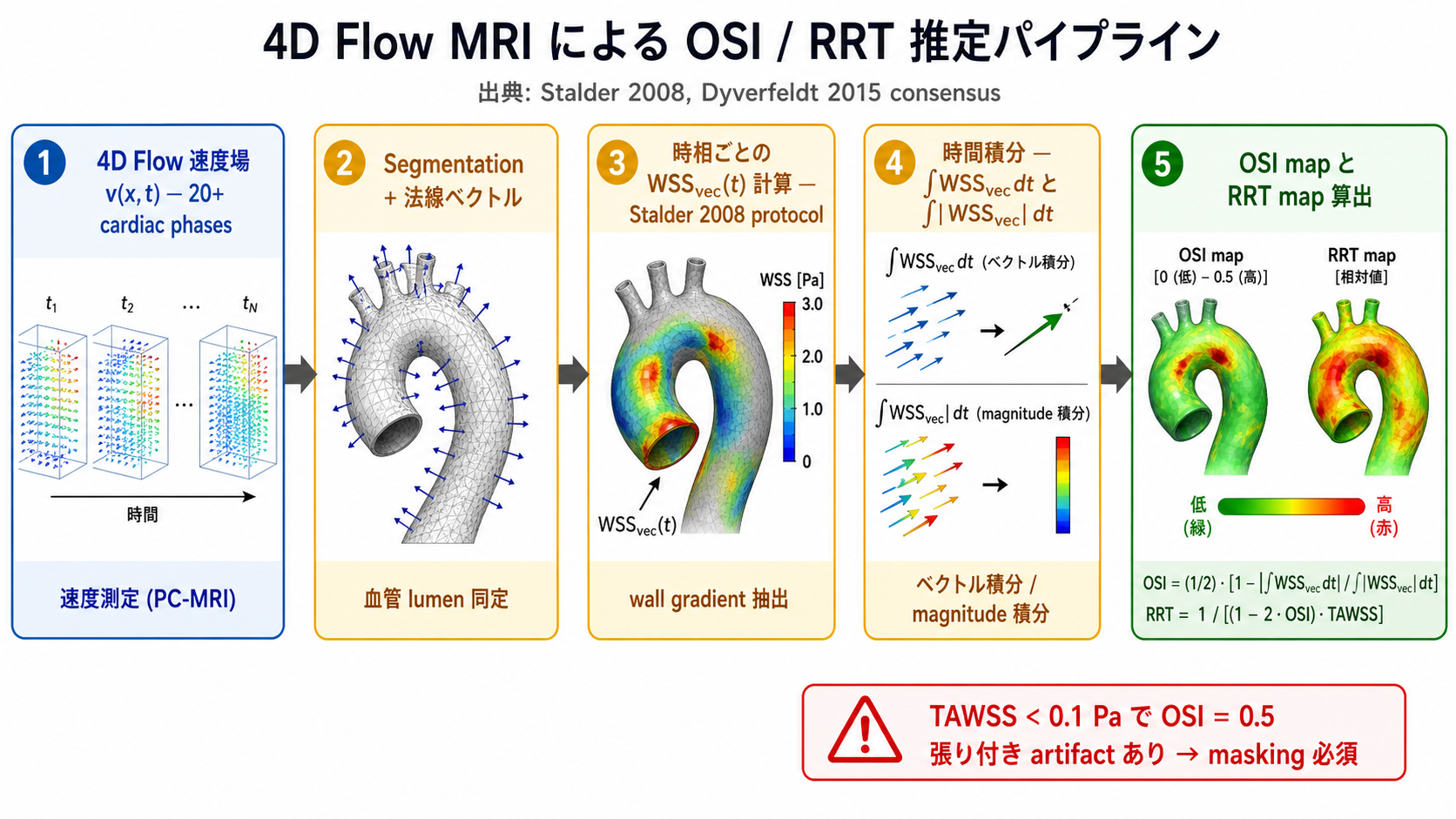 4D Flow MRI による OSI / RRT 推定の 5 ステップパイプライン