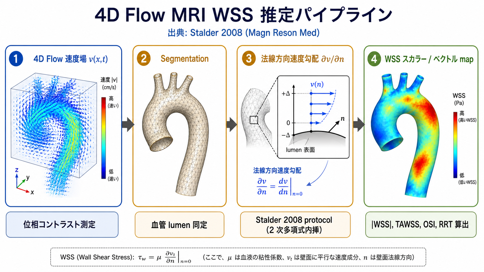 4D Flow MRI による WSS 推定の 4 ステップパイプライン